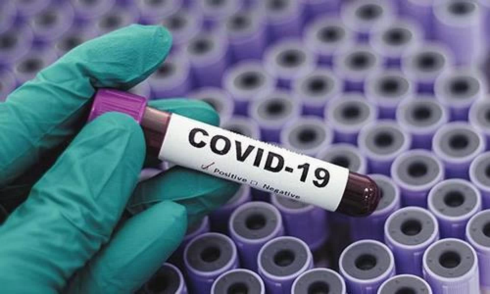 Κορονοϊός: Ανακριβή τα σημερινά μοριακά τεστ - Μπορεί να δώσουν ψευδώς αρνητικά αποτελέσματα